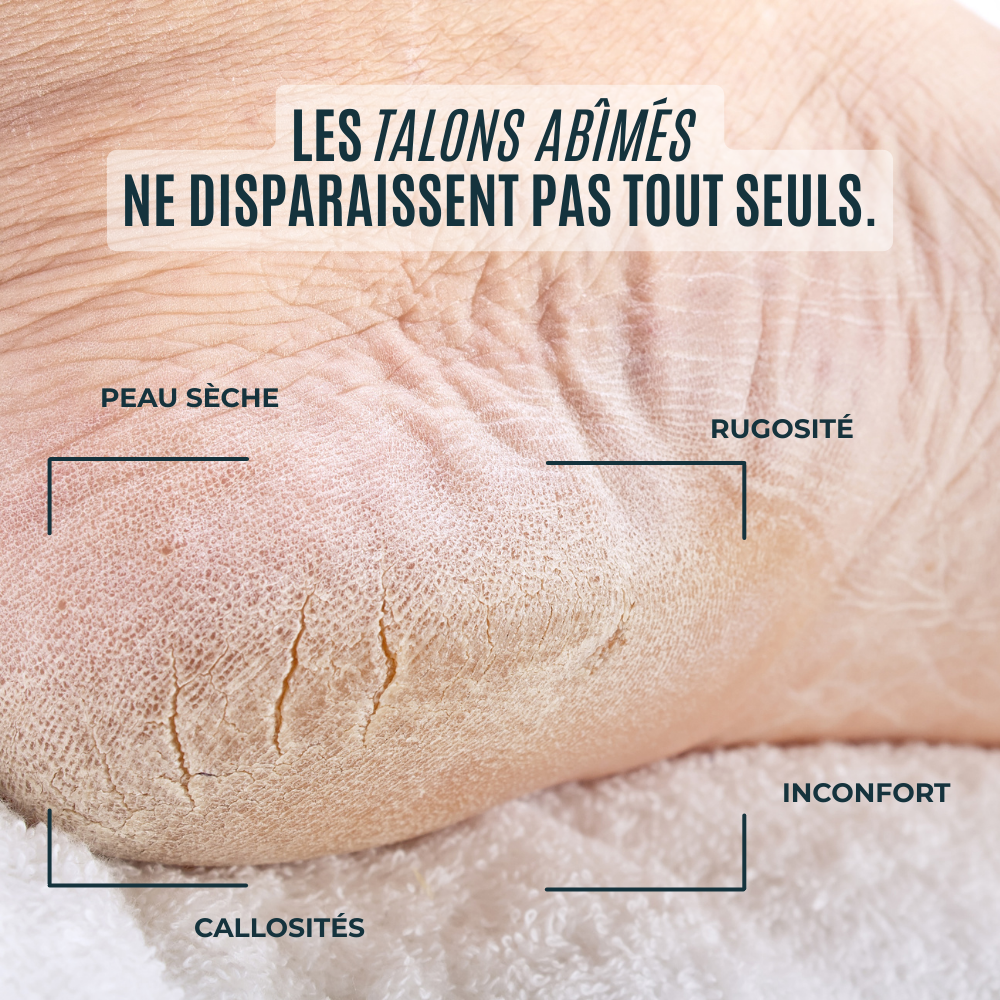 Lime en Nano-Verre pieds impeccables